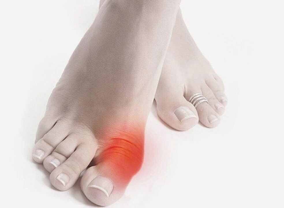 drop foot symptoms